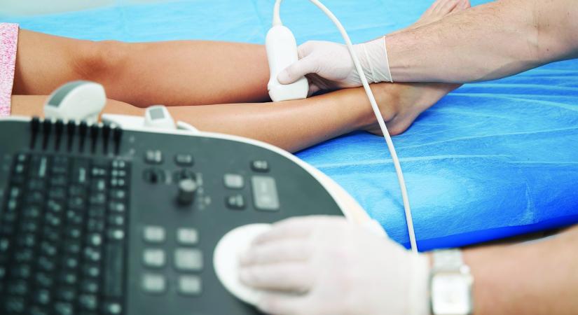 Infúziós terápiával mérsékelhető az amputáció kockázata - Medical Online