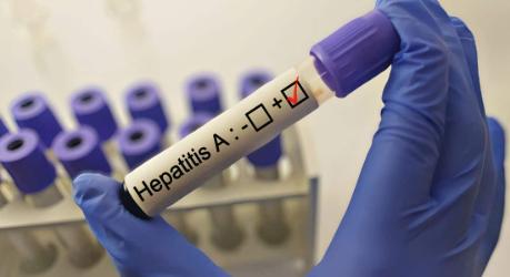 Hepatitis A fertőzést jelentettek az egyik hegyvidéki óvodában! - Ittlakunk