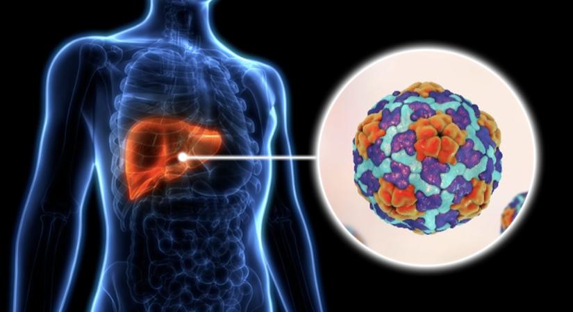 Csökken a hepatitis A megbetegedések száma - Demokrata