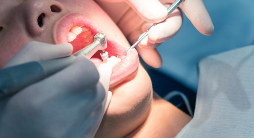 Gyökérkezeléseket is végzett a cseh álfogorvos: a neten nézte meg, hogyan kell csinálni - 24.hu