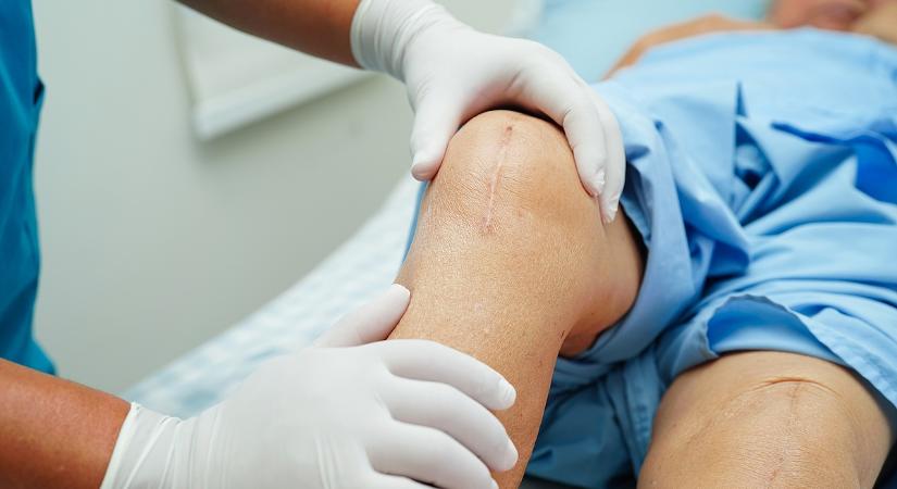 Nem csökkennek a várólisták, sőt – Mutatjuk a friss számokat - Napi.hu