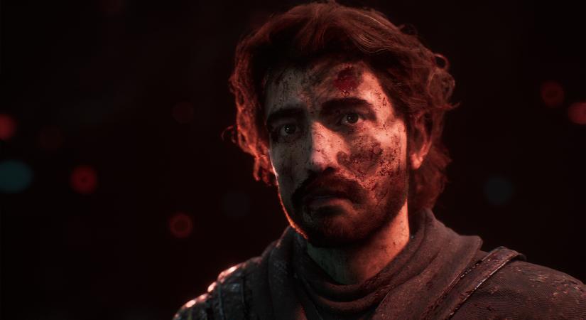A Daredevilt alakító Charlie Cox „totális csalónak” érzi magát, amikor gratulálnak neki a Clair Obscur miatt - IGN