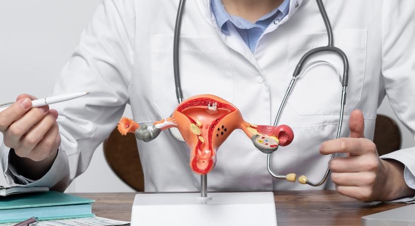 Mióma a menopauza után – kell-e aggódni? - Patika Magazin