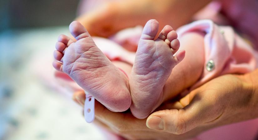 Hiba császármetszés során: a baba arcát is megvágta az orvos - Babaszoba