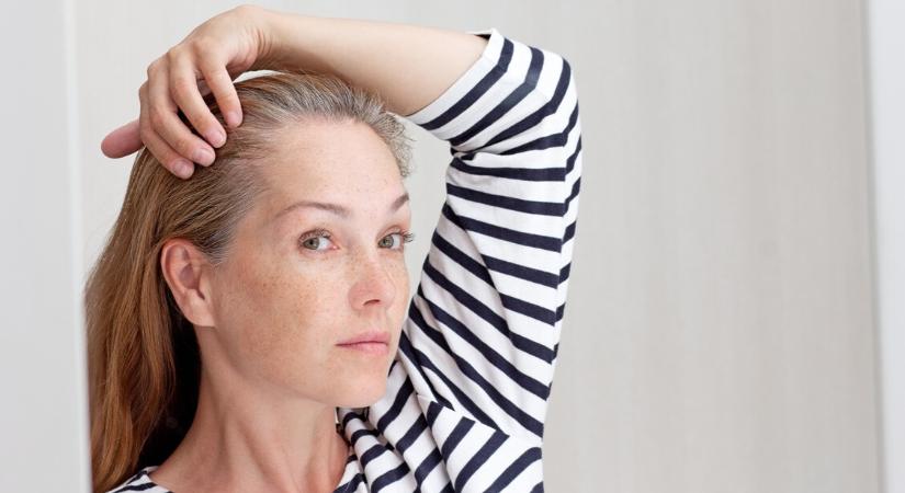 Őszülés ellen ezek a legjobb vitaminok: természetes módon lassítják a folyamatot - HáziPatika