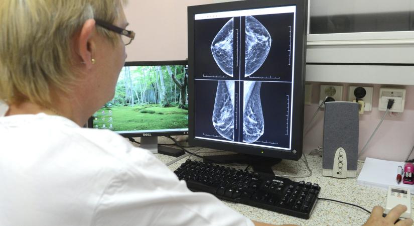 Šaško: Júliustól elérhető lesz a mamográfiás emlőszűrés a 45 év feletti nőknek - Körkép