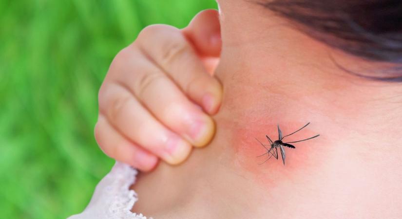 Így segít a szódabikarbóna, ha megcsípett a szúnyog