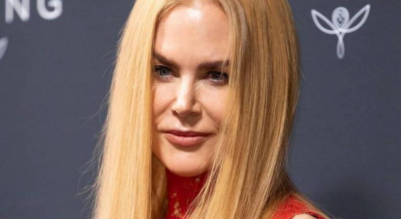„Ez kinek az arca?” – Nicole Kidmanre rá se ismernek a rajongók friss fotója láttán