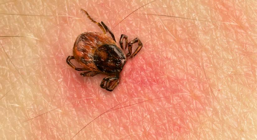 Most érkezett: egy 9 éves kislány kapta el a legsúlyosabb kullancsok által terjesztett fertőzést