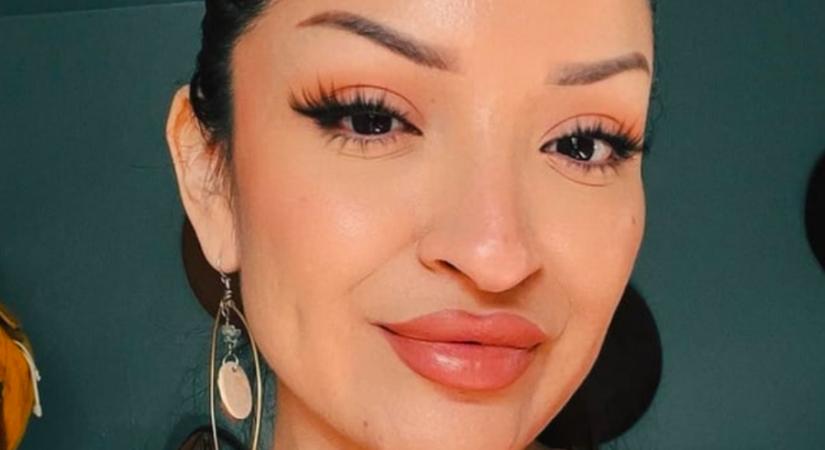 Élete álma teljesült az orrműtéttel: amikor meglátja a végeredményt, elakad a szava - Videó