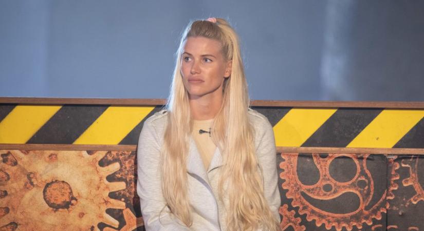 Vasvári Vivien a plasztikáról: „Sokan nekem esnek, hogy mit csináltatok az arcommal, pedig semmit”