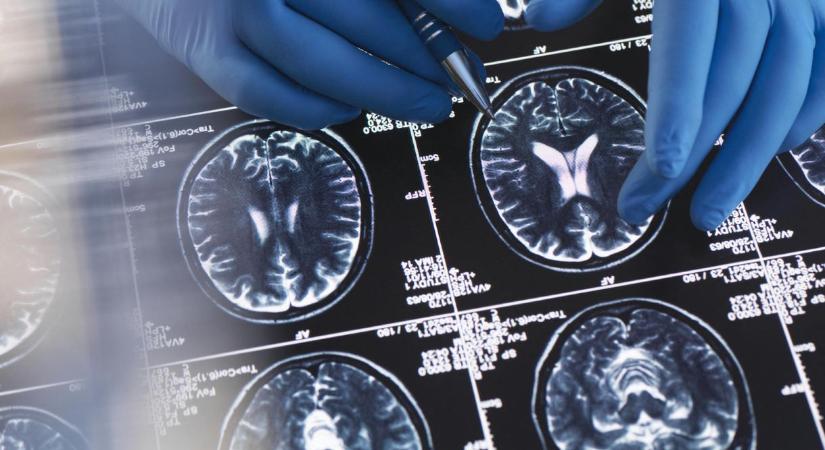 85-20 a gép javára, legyőzte az orvosokat egy új diagnosztikai eszköz