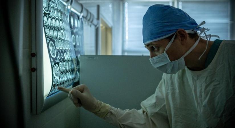 Egyetlen agyi felvételből megállapítható az öregedés üteme