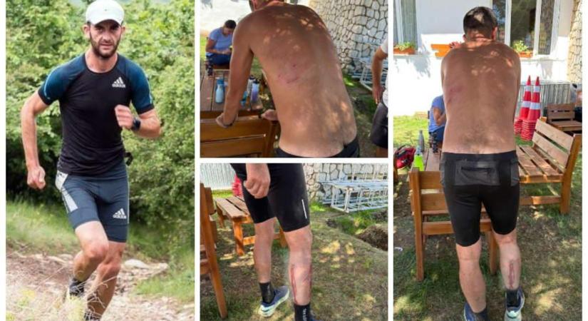 Az életéért küzdött az atlétikaedző, akire nyolc kutya támadt rá Biharfüred közelében – hírmix