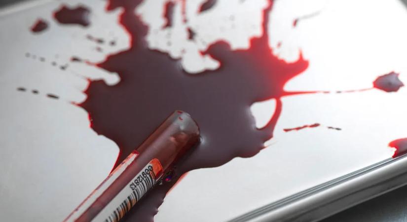 Ijesztő felfedezés: ha ilyen vércsoportod van, hamarabb meghalhatsz