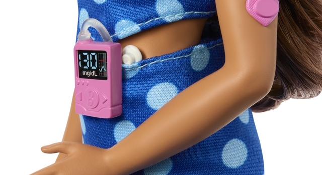 Barbie új kiegészítői a glükózszenzor és az inzulinpumpa