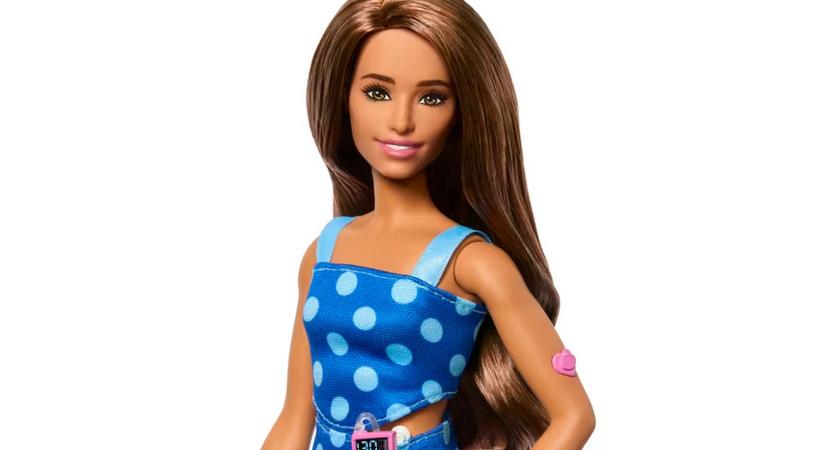 Cukorbeteg Barbie babát kezdenek forgalmazni – a cél a diabétesszel élők iránti empátia erősítése