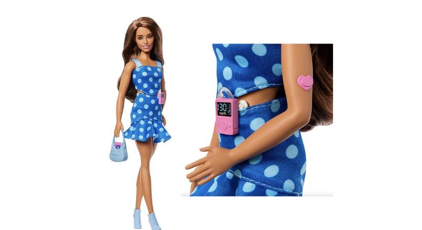 Cukorbeteg Barbie babát dobtak piacra – képgaléria