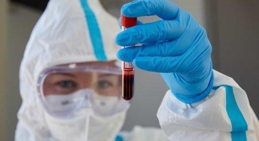 Oroszország túljutott a koronavírusos megbetegedések esetszámának tetőzésén