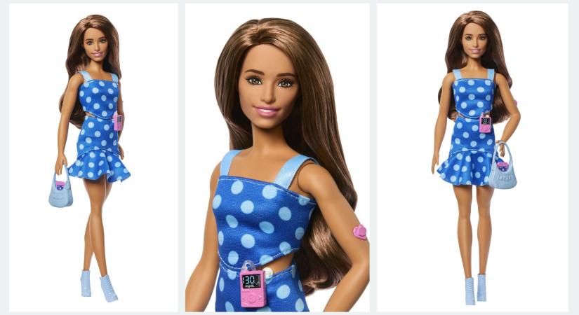 Az új Barbie fontos témára hívja fel a figyelmet: cukorbeteg Barbie babát jelentett be a Mattel