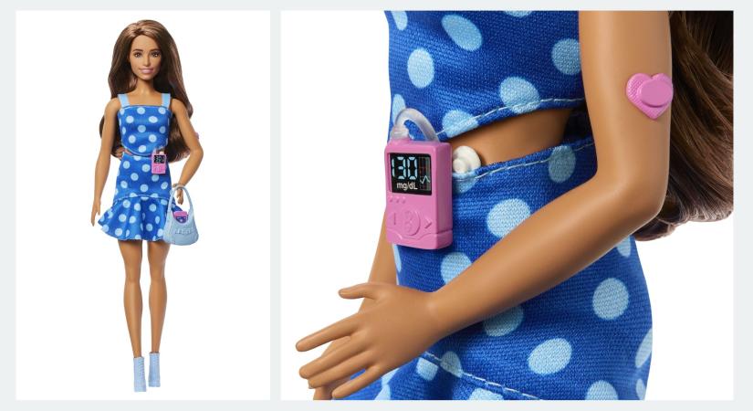 Barbie új kiegészítői a glükózszenzor és az inzulinpumpa: itt a cukorbeteg Barbie baba