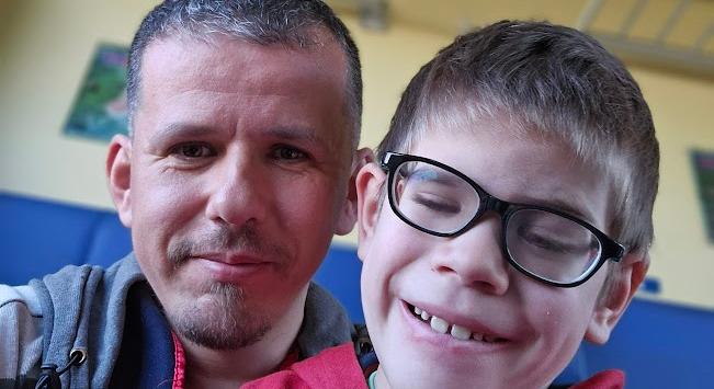 Ha Bence beüti a fejét, megvakulhat – Az egész világon 90 embernek van ilyen betegsége