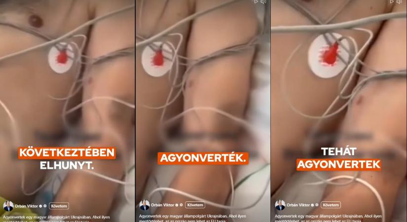 Rácz András: Egy másik férfiről készült felvételt is belevágtak abba a videóba, amin Orbán Viktor Sebestyén József haláláról beszél