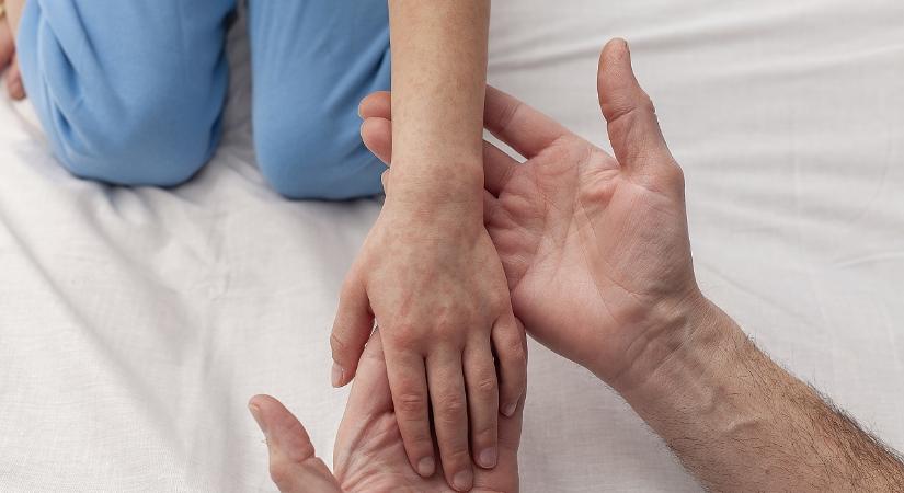 Újra terjed a kanyaró: halálos áldozatot követelt a vírus