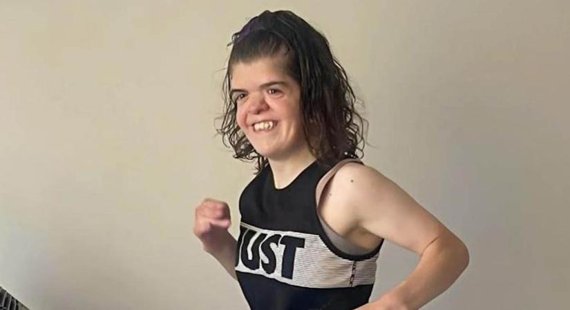 Születése pillanatában lemondtak róla az orvosok, most lefutott egy maratont