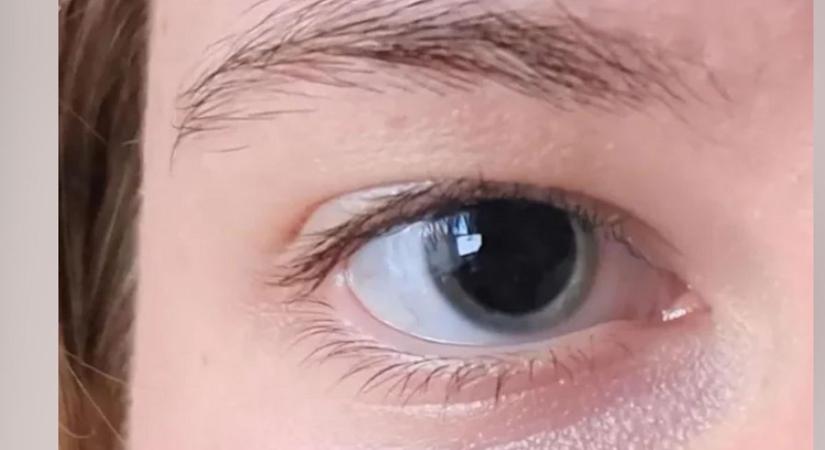Közösségi oldalán megosztott fotója mentette meg egy nő életét