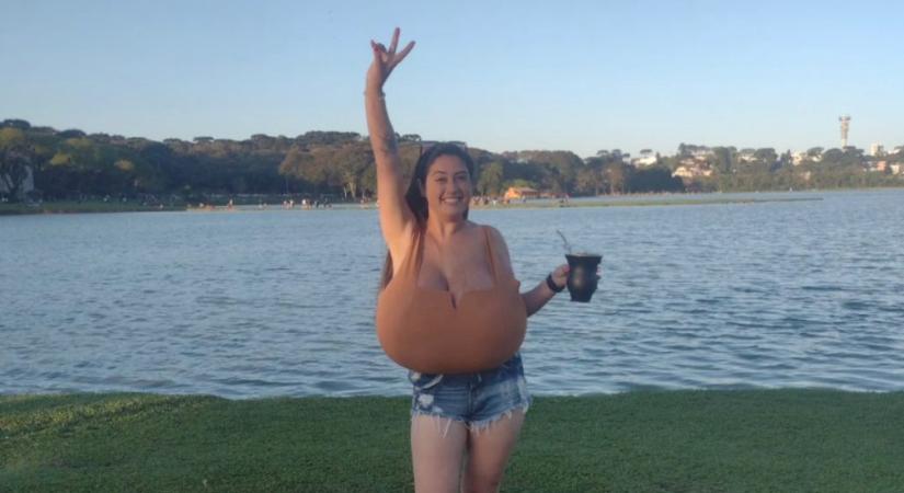 Annyira megnőtt a 22 éves brazil nő melle, hogy kerekesszékre volt szüksége