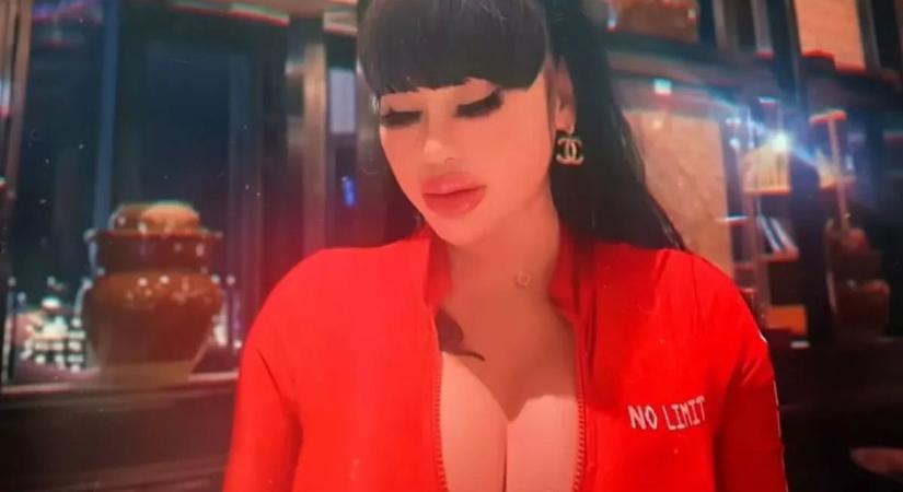 Nem áll le: életveszélyes bordaeltávolításra készül a rapper, hogy vékonyabbnak tűnjön