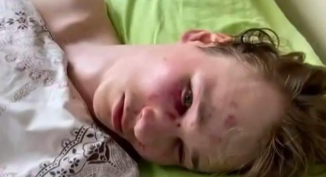 Az ukránok szerint magát verte meg egy fiú a kényszersorozáskor