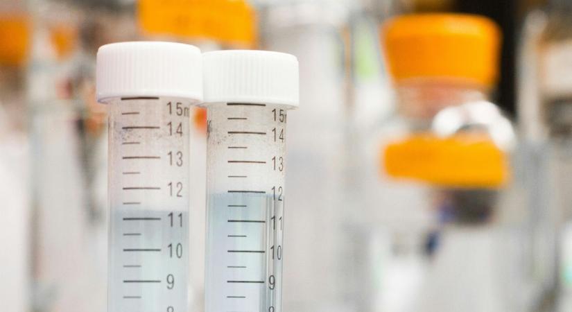 Legionella baktérium egy tátrai hotel pezsgőfürdőjében - Emiatt halhatott meg egy 65 éves nő