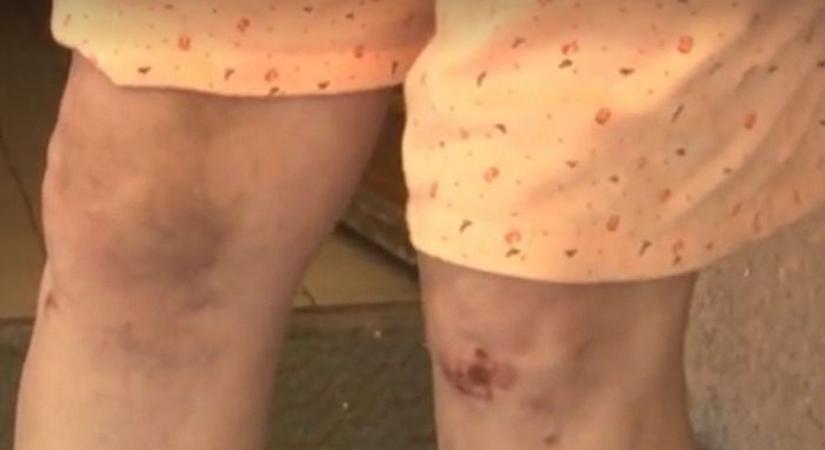 Brutális támadás Ózdon, visszarángatták a házába a menekülő nyugdíjast, hogy tovább verjék – videóval