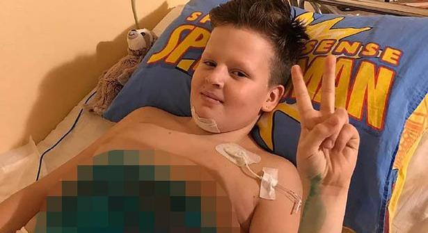 Mindkét lábát elveszítette egy 11 éves fiú egy vonatbalesetben