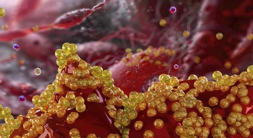 Gyerekekre veszélyes antibiotikumrezisztens baktérium terjed: Magyarországot talán még nem érte el