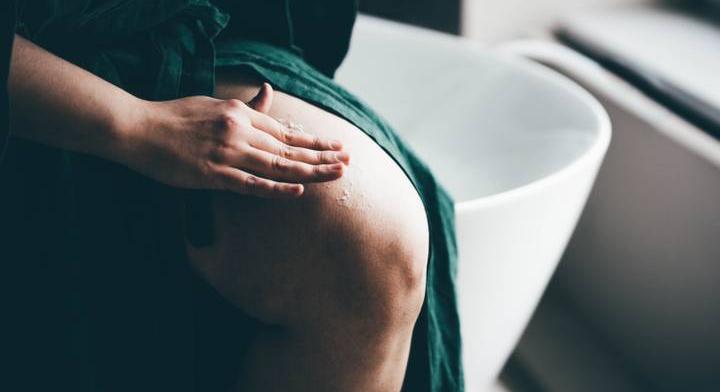Cellulitisz: tények és tévhitek a leggyűlöltebb bőrhibáról