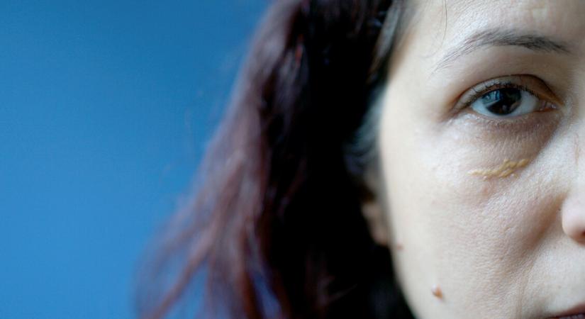Színek, amelyekkel üzen a testünk: baj van - KVÍZ