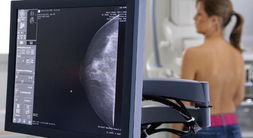 Kapolcson megmutatták: így kell rávenni a nőket az életmentő vizsgálatra
