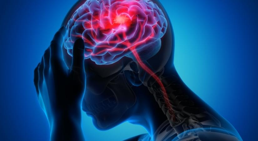 Inkább ne csináld: ez a délutáni szokás 30%-kal növelheti a stroke kockázatát