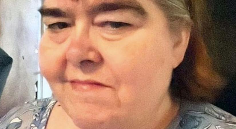 Még a kiérkező hatóságok is összerezzentek a látványtól: egy nő annyira elhanyagolta a fiát, hogy amputálni kellett a lábait