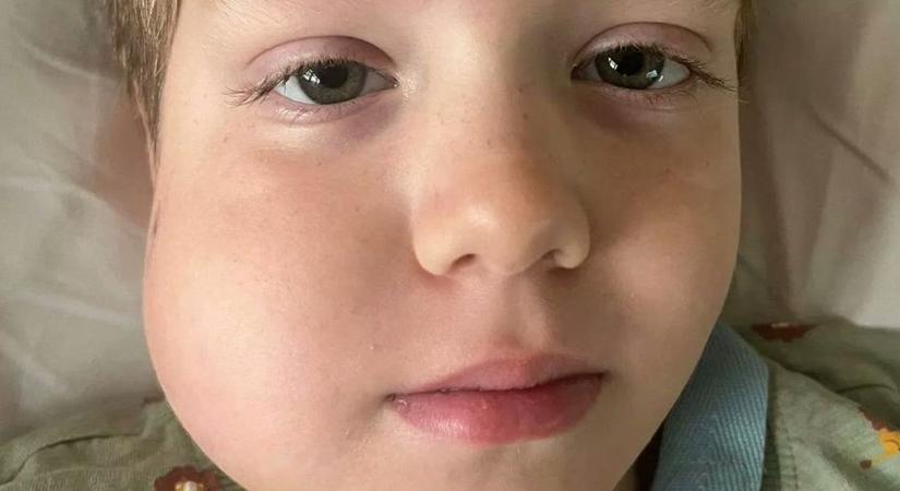 Mozgott a 7 éves kisfiú foga, kiderült rákkal küzd: „Semmi sem segített”