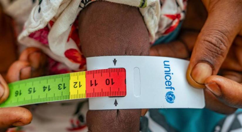 A lakosság 20%-a éhezik: döbbenetes adatokat közölt az ENSZ 2025-ös jelentése