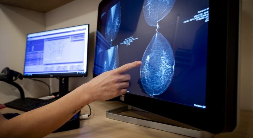 Viszlát, mammográfia? Találtak egy sokkal pontosabb módszert
