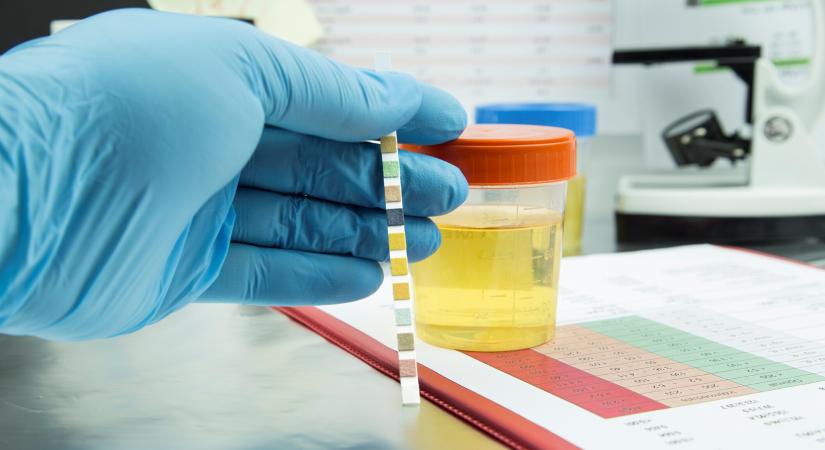 Vesefunkciók vizsgálata cukorbetegeknél: miért életbevágó?