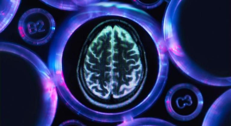 Van valami közös az agyunkban és az akkumulátorokban, és ez az Alzheimer-kór kialakulásában is szerepet játszhat