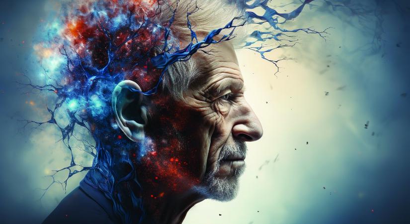 Az Alzheimer-kór kialakulásának okait vizsgálják szegedi kutatók