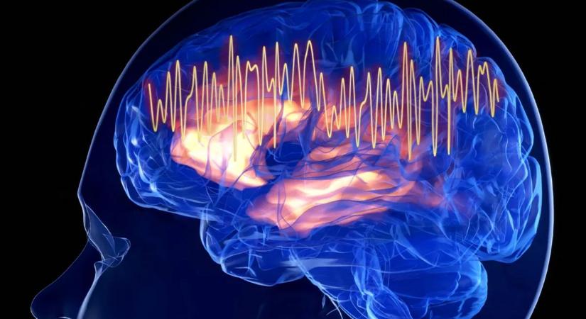 Tévedtünk az Alzheimer-kór okával kapcsolatban? Új nyomra bukkanhattak a tudósok