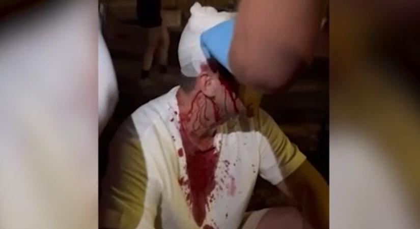 Beverték az ellenzéki képviselő fejét a haladók verőemberei